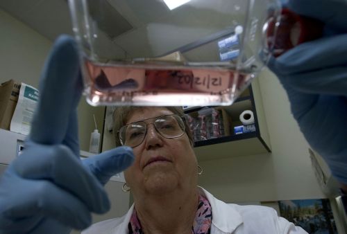 Γενετική ανακάλυψη ανοίγει το δρόμο για νέο διαγνωστικό τεστ του καρκίνου του προστάτη