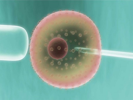 Λιγότερες πιθανότητες επιτυχίας της εξωσωματικής γονιμοποίησης για τις παχύσαρκες γυναίκες