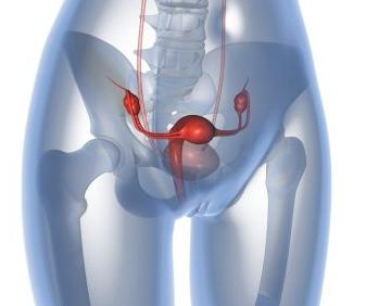 Οι κύστες στις ωοθήκες δεν συντελούν στην εκδήλωση καρκίνου