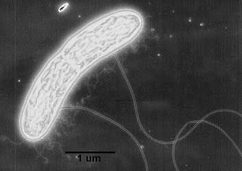 Πώς ένα μικρόβιο μπορεί να απομακρύνει πυρηνικά απόβλητα