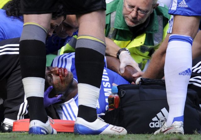 Οι εφιάλτες και η τύχη του Ντρογκμπά