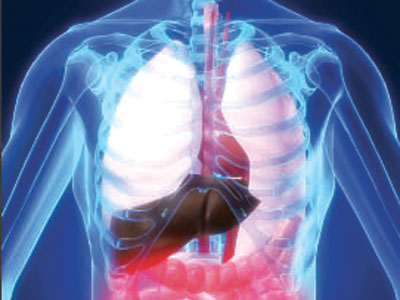 Κίνδυνος καρδιαγγειακού επεισοδίου για τις γυναίκες με χρόνια δυσκοιλιότητα