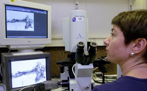 Αυξάνεται κατακόρυφα το κόστος θεραπείας του καρκίνου, προειδοποιούν ειδικοί