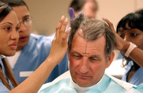 Λιποκύτταρα χαρίζουν πλούσια κόμη σε φαλακρά πειραματόζωα