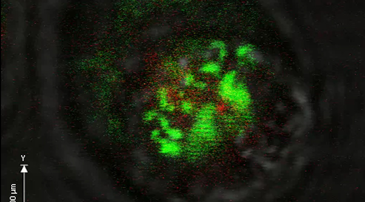 Τρισδιάστατο βίντεο δείχνει πώς τα λευκά αιμοσφαίρια επιτίθενται σε εισβολείς