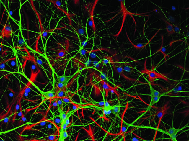 Οι νευρώνες του εγκεφάλου αλλάζουν μόνοι τους το γενετικό τους υλικό