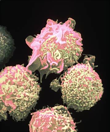 Πειραματική δραστική ουσία εξοντώνει τη λευχαιμία