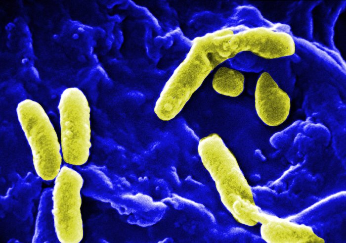 Τα πολυανθεκτικά μικρόβια υπεύθυνα για το 40,5% των θανάτων από ενδονοσοκομειακές λοιμώξεις