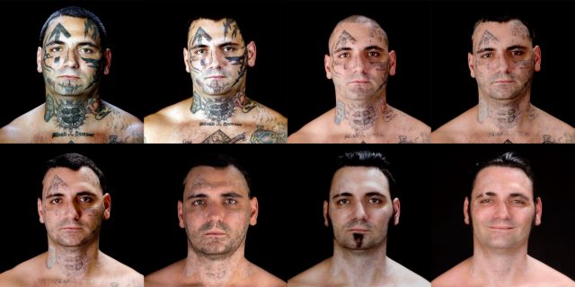 Μετανοημένος «σκίνχεντ» υπομένει το μαρτύριο για να αφαιρέσει τα τατουάζ