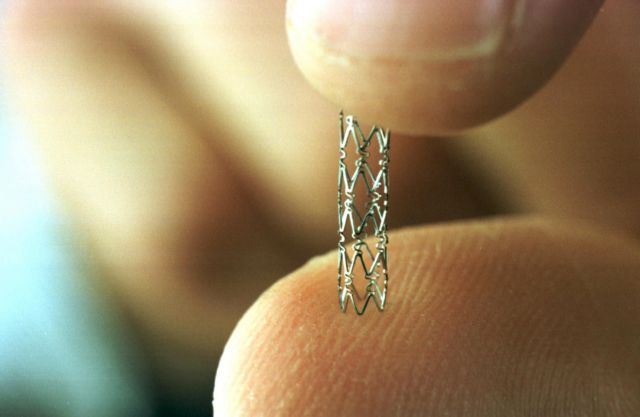 Αντιμετώπιση της στυτικής δυσλειτουργίας με αγγειοπλαστική