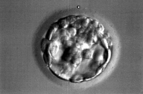 Βλαστικά κύτταρα τώρα και από την κλωνοποίηση ασθενών