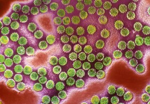 Ο ιός HPV «ύποπτος» για έμφραγμα και εγκεφαλικό επεισόδιο