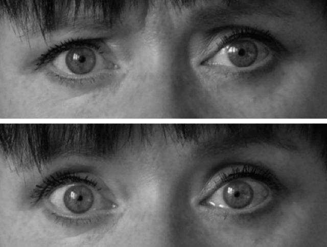 Ο υπνωτισμός «φέρνει τον εγκέφαλο σε ιδιαίτερη συνειδησιακή κατάσταση»