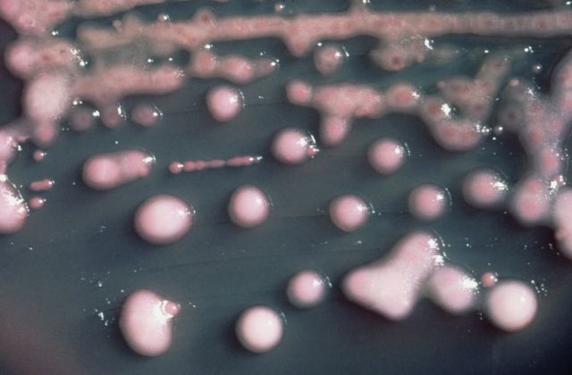 «Κρίσιμη» η κατάσταση με τα πολυανθεκτικά μικρόβια στην Ευρώπη