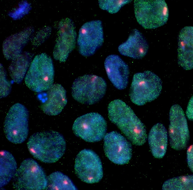 Κύτταρα ηλικιωμένων μετατρέπονται σε εμβρυϊκά βλαστοκύτταρα
