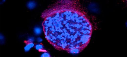 Κοινό παράσιτο επηρεάζει τη χημεία του εγκεφάλου, ίσως και τη συμπεριφορά