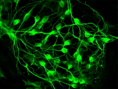 Επιτυχημένη μετατροπή βλαστοκυττάρων σε εγκεφαλικούς νευρώνες