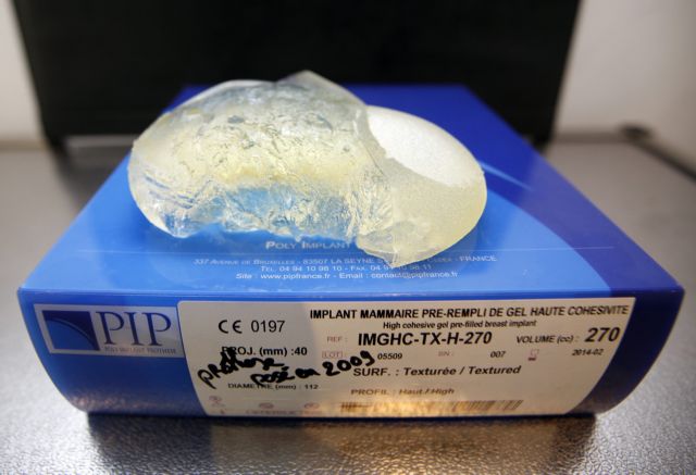 Χιλιάδες Γαλλίδες καλούνται να αφαιρέσουν προληπτικά τα εμφυτεύματα στήθους