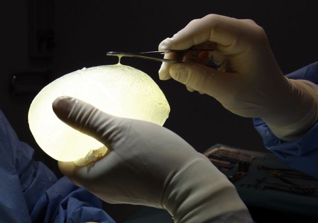 Με έξοδα της γαλλικής κυβέρνησης η αφαίρεση των εμφυτευμάτων στήθους