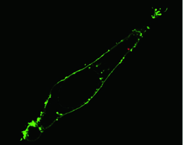 Πρωτοποριακό ενδοσκόπιο κατασκοπεύει το εσωτερικό κυττάρων