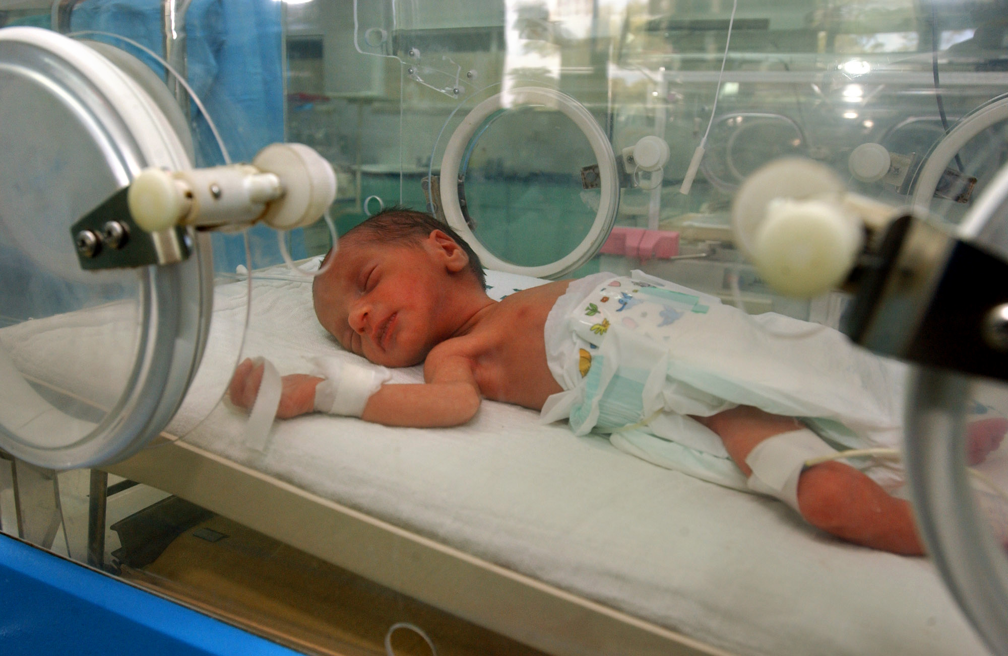 Γνωστικά προβλήματα και στην ενήλικη ζωή για τα παιδιά που έχουν γεννηθεί πρόωρα