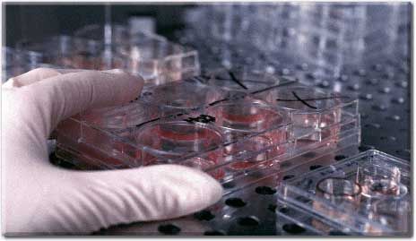 H Γερμανία επικρίνει την απόφαση του Ευρωδικαστηρίου για τα βλαστοκύτταρα