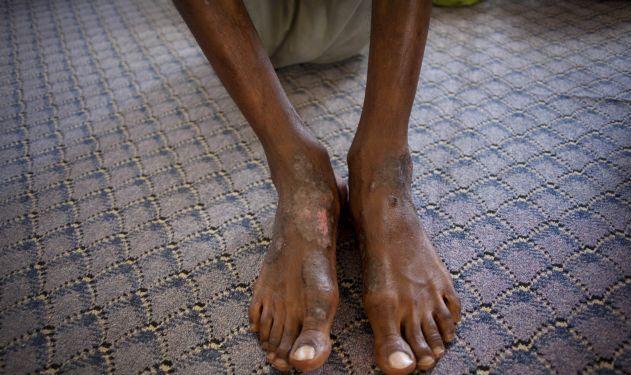 Βασανιστήρια με ηλεκτροσόκ καταγγέλλουν κανταφικοί σε κέντρα κράτησης της Λιβύης