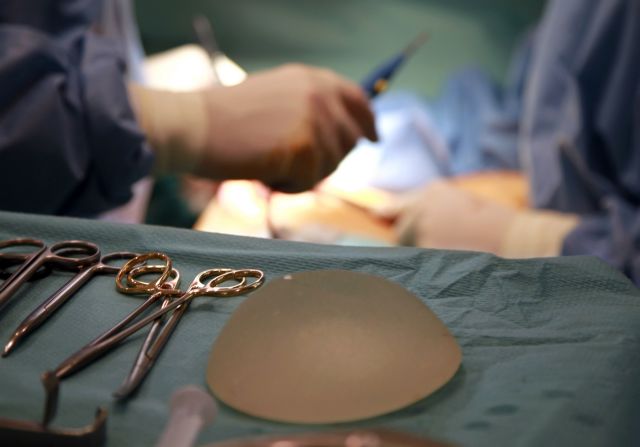 Σαράντα οι γυναίκες στην Ελλάδα με ακατάλληλα εμφυτεύματα σιλικόνης, λέει ο ΕΟΦ