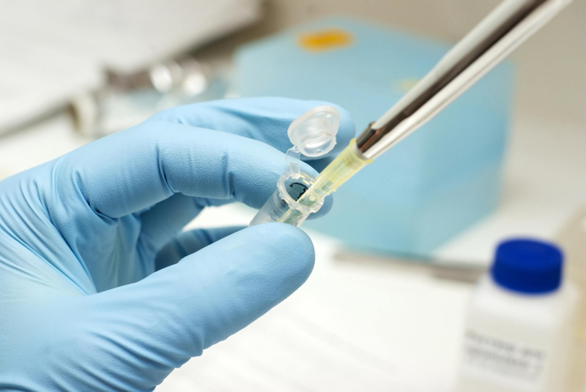 Εμβόλια κατά της ηπατίτιδας C και του AIDS, δημιουργούν επιστημονική αισιοδοξία