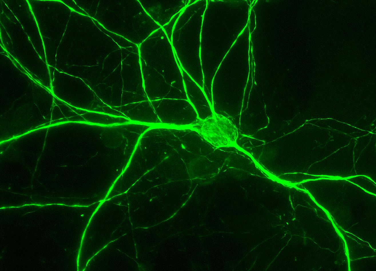 Νευρώνες από κύτταρα δέρματος τώρα σε ένα μόνο βήμα