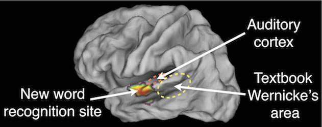 Σε άλλο σημείο του εγκεφάλου τελικά το κέντρο του λόγου