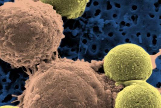 Αντίσωμα γενικής χρήσης υπόσχεται να τα βάλει με ιώσεις