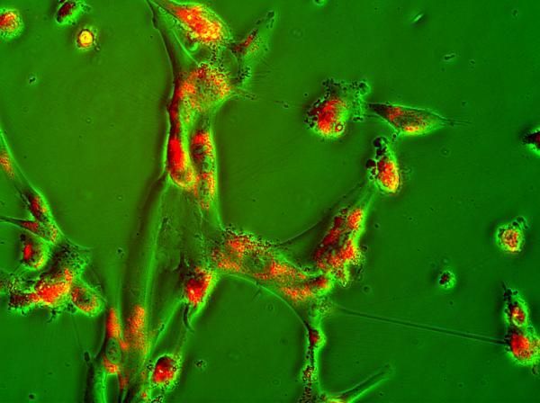 Θεραπεία βλαστοκυττάρων θα δοκιμαστεί για πρώτη φορά κατά της κώφωσης