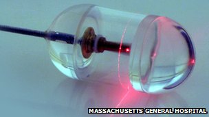 Κάμερα σε μέγεθος χαπιού «υπόσχεται» τρισδιάστατη απεικόνιση του οισοφάγου