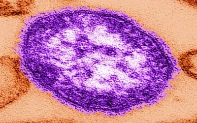 Στον αέρα η προσπάθεια εξάλειψης της ιλαράς από την Ευρώπη