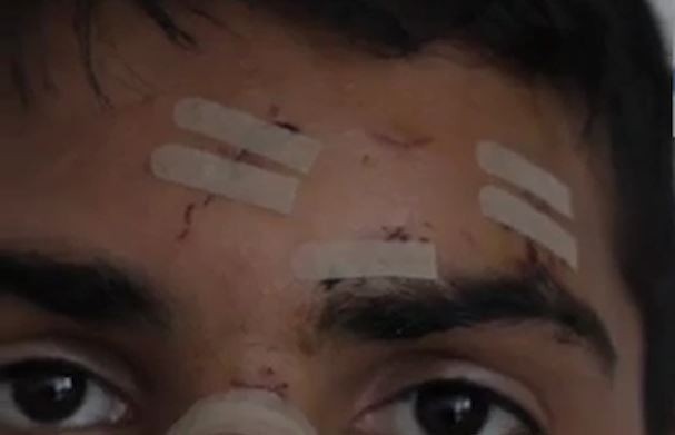 Έρευνα για την κακοποίηση του 15χρονου Αφγανού