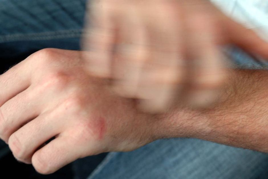 Χρόνια Αυθόρμητη Κνίδωση: Καλύτερη ποιότητα ζωής με ομαλιζουμάμπη