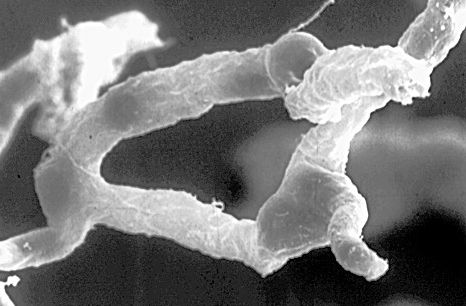 Τεχνική υπερήχων ανοίγει τον αιματοεγκεφαλικό φραγμό