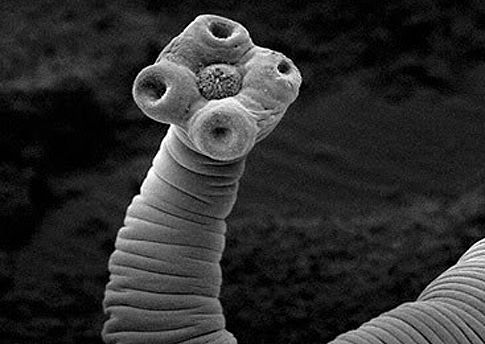 «Έκπληκτοι» οι γιατροί με παρασιτικό σκουλήκι που εξαπλωνόταν σαν καρκίνος