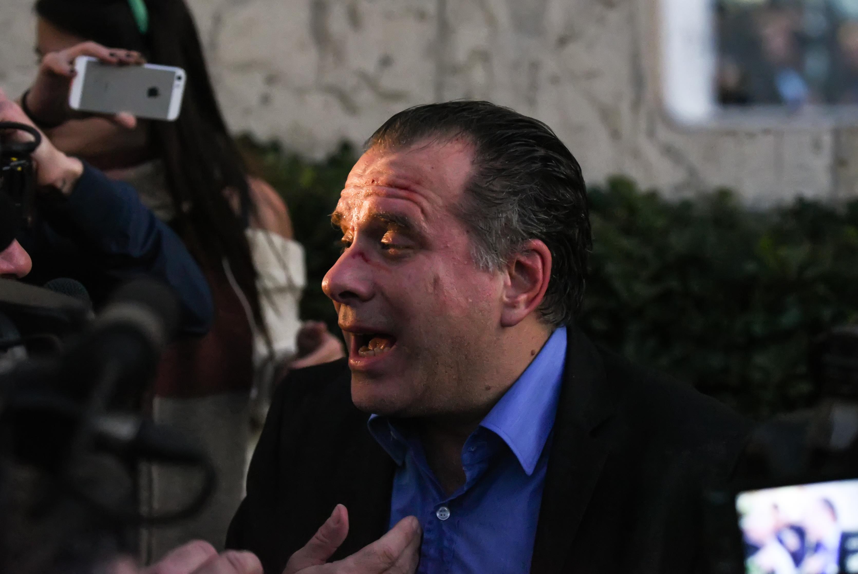 Αναβάλλεται η δίκη του κατηγορούμενου για την επίθεση στον Κουμουτσάκο