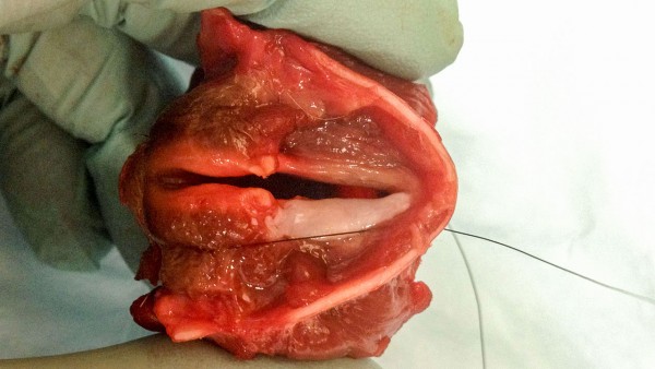 Ερευνητές ανέπτυξαν για πρώτη φορά λειτουργικές φωνητικές χορδές