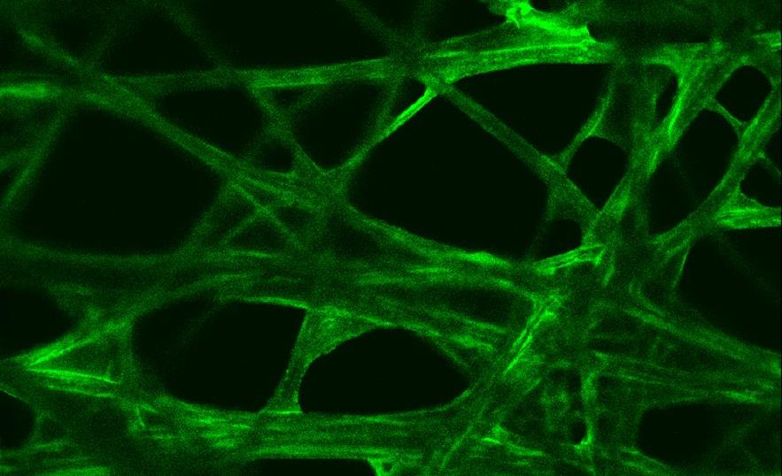 Εκδήλωση «Φως και Ζωή» την Τρίτη στο Πανεπιστήμιο Πατρών