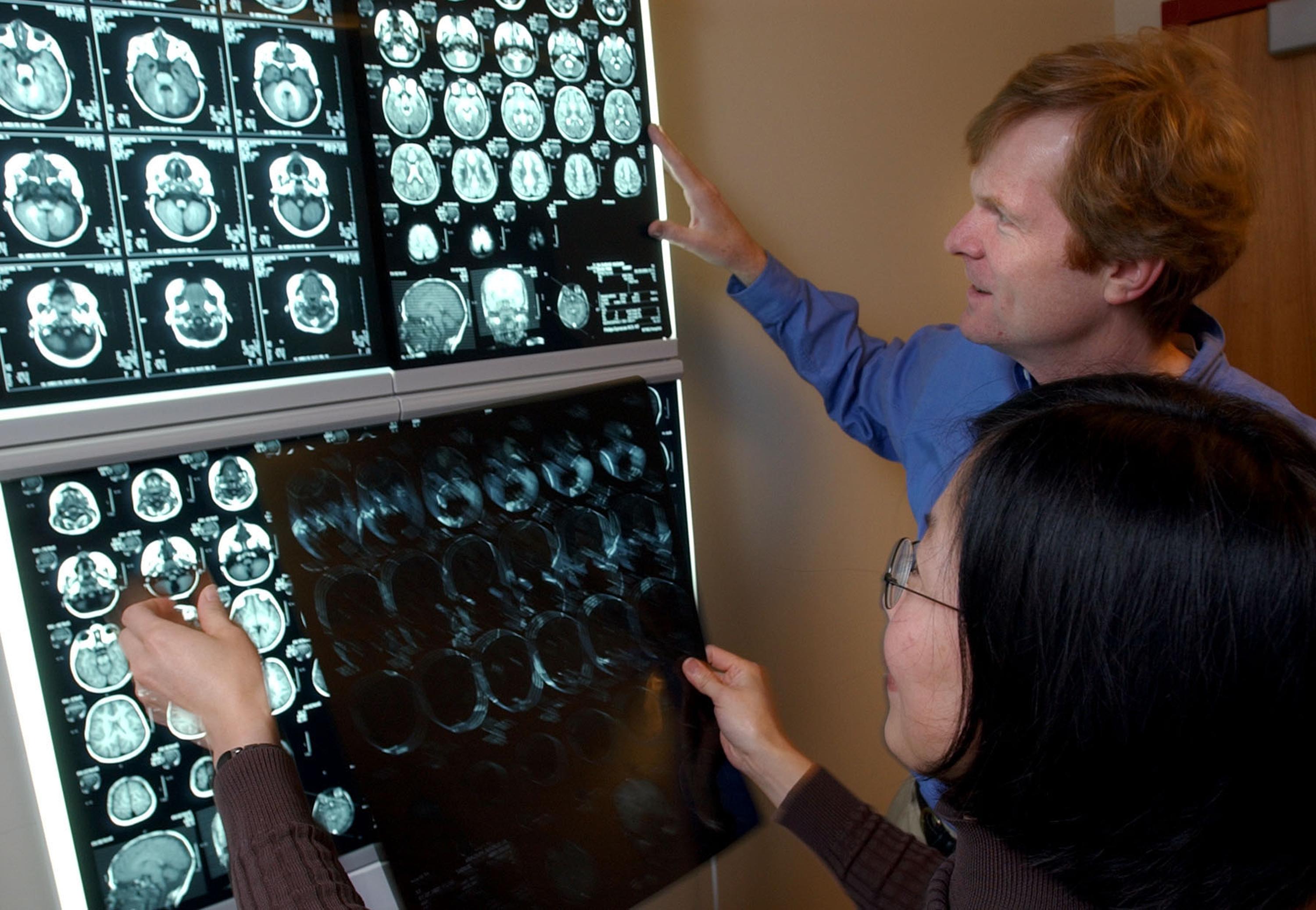 Νέα τεχνική εντοπίζει επιθετικούς καρκίνους πριν γίνουν μετασταστικοί