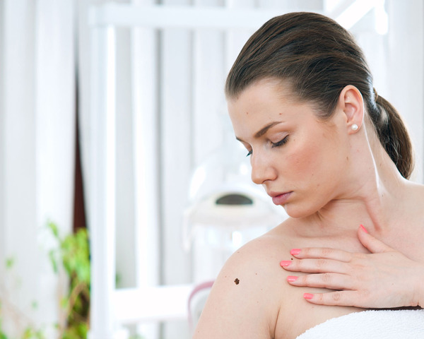 Πιο επιθετικός ο καρκίνος του δέρματος όταν εκδηλώνεται κατά την κύηση