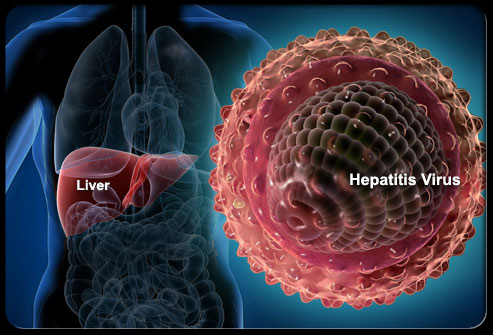 Ηπατίτιδα C: Νέα θεραπεία επιτυγχάνει υψηλά ποσοστά ιολογικής ανταπόκρισης