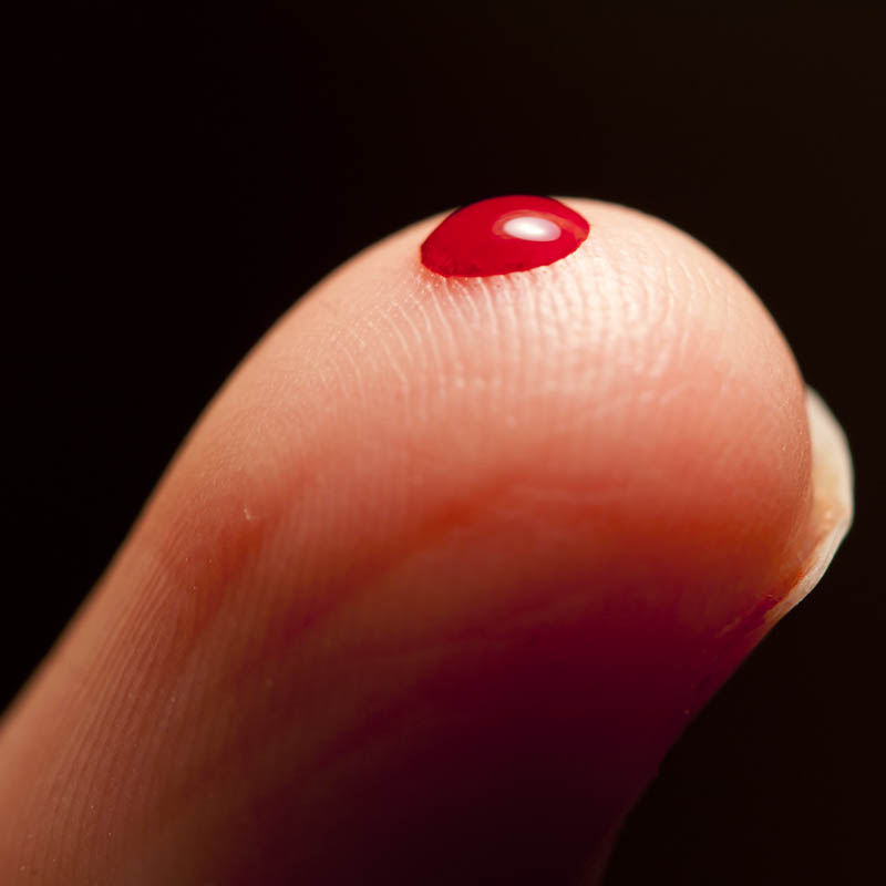 Α.Περδίκης: Αγάπη και αισιοδοξία τα καλύτερα όπλα κατά της αιμορροφιλίας