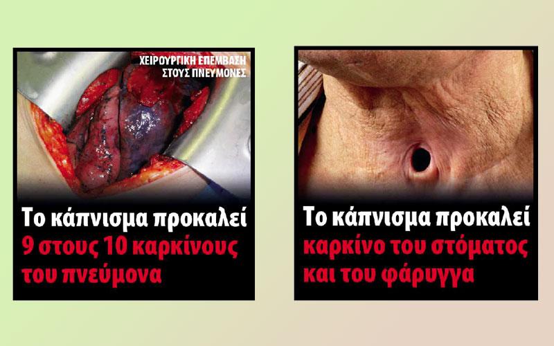 Με αποκρουστικές εικόνες για τις συνέπειες του καπνίσματος τα νέα πακέτα τσιγάρων
