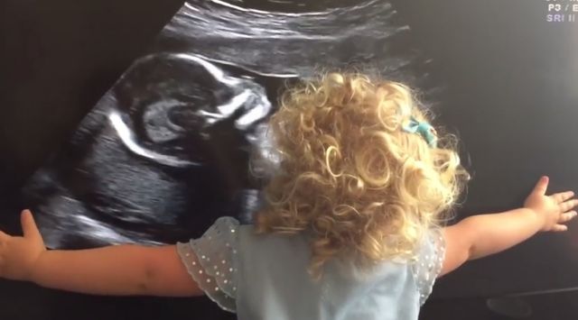 Ανυπομονεί για το αδελφάκι της και αγκαλιάζει το υπερηχογράφημα