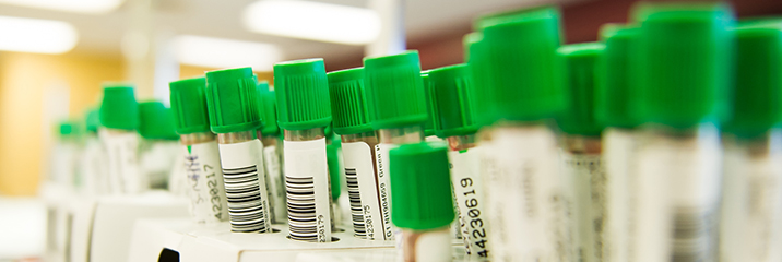 FDA: Έγκριση εξέτασης για λήπτες μοσχεύματος αιμοποιητικών βλαστοκυττάρων