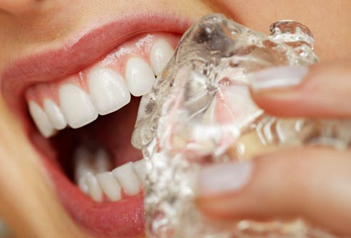 Επτά συνήθειες που κάνουν κακό στα δόντια μας το καλοκαίρι
